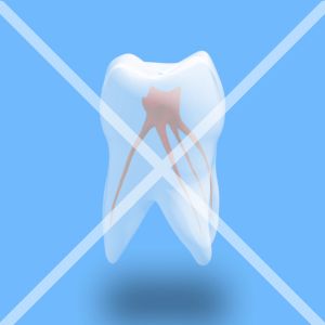 歯の神経治療がいい加減