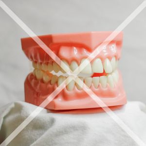 歯の噛み合わせの調整が不十分