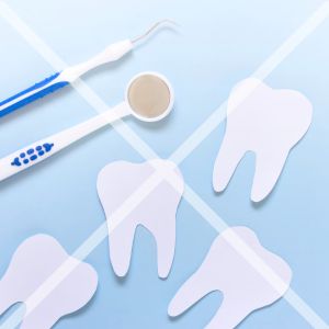 セラミック矯正後のメンテナンス不足