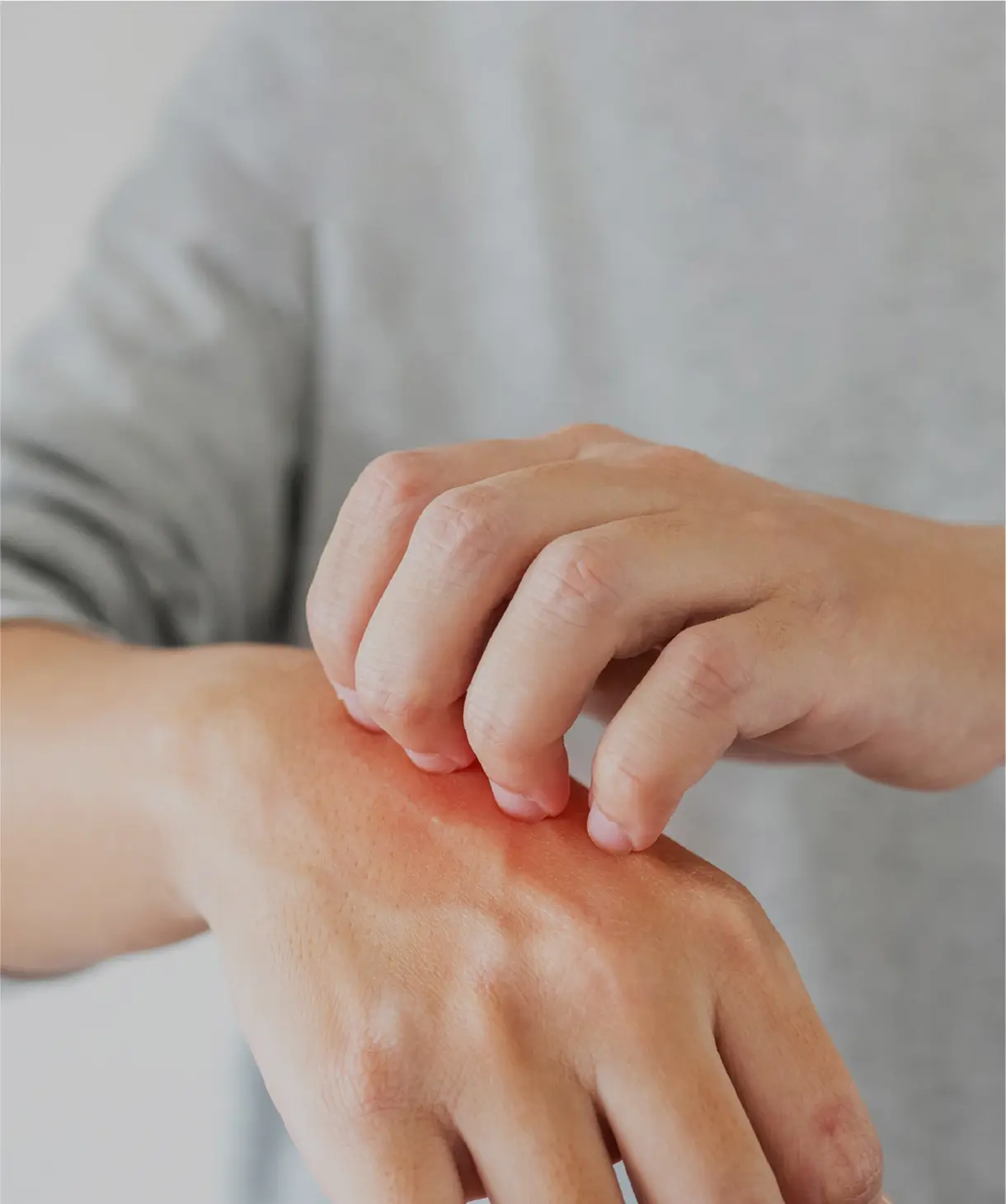 金属アレルギーかもしれない？もしかすると、銀歯などの金属が原因かも？