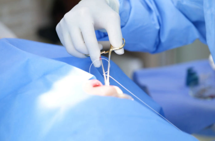 金属アレルギー歯科治療の多様な料金設定